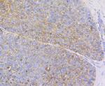 Cytokeratin 17 Antibody in Immunohistochemistry (Paraffin) (IHC (P))