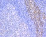 Cytokeratin 17 Antibody in Immunohistochemistry (Paraffin) (IHC (P))