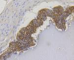 Cytokeratin 17 Antibody in Immunohistochemistry (Paraffin) (IHC (P))