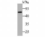 Cytokeratin 17 Antibody in Western Blot (WB)