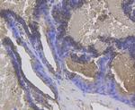Cytokeratin 17 Antibody in Immunohistochemistry (Paraffin) (IHC (P))