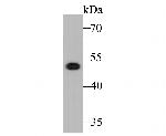 Cytokeratin 17 Antibody in Western Blot (WB)