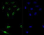 GATA3 Antibody in Immunocytochemistry (ICC/IF)