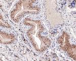 GATA3 Antibody in Immunohistochemistry (Paraffin) (IHC (P))