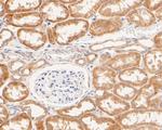 P2X7 Antibody in Immunohistochemistry (Paraffin) (IHC (P))