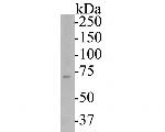 P2X7 Antibody in Western Blot (WB)