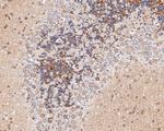 GABRA1 Antibody in Immunohistochemistry (Paraffin) (IHC (P))