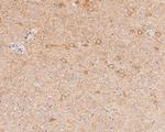 GABRA1 Antibody in Immunohistochemistry (Paraffin) (IHC (P))