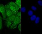 Progesterone receptor Antibody in Immunocytochemistry (ICC/IF)