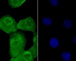 Progesterone receptor Antibody in Immunocytochemistry (ICC/IF)