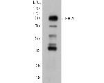 Progesterone receptor Antibody in Western Blot (WB)