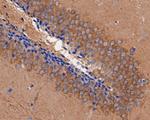 P2X7 Antibody in Immunohistochemistry (Paraffin) (IHC (P))