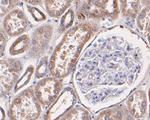 P2X7 Antibody in Immunohistochemistry (Paraffin) (IHC (P))