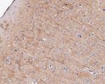 P2X7 Antibody in Immunohistochemistry (Paraffin) (IHC (P))