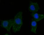 KCNMA1 Antibody in Immunocytochemistry (ICC/IF)