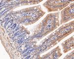 KCNMA1 Antibody in Immunohistochemistry (Paraffin) (IHC (P))