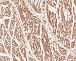 DNMT3A Antibody in Immunohistochemistry (Paraffin) (IHC (P))