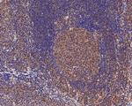 DNMT3A Antibody in Immunohistochemistry (Paraffin) (IHC (P))