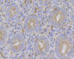 ERN1 Antibody in Immunohistochemistry (Paraffin) (IHC (P))