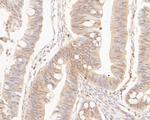 CPEB1 Antibody in Immunohistochemistry (Paraffin) (IHC (P))