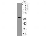 CPEB1 Antibody in Western Blot (WB)