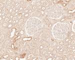 TREM2 Antibody in Immunohistochemistry (Paraffin) (IHC (P))