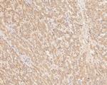 TREM2 Antibody in Immunohistochemistry (Paraffin) (IHC (P))