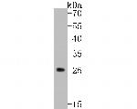 TREM2 Antibody in Western Blot (WB)