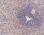 CD180 Antibody in Immunohistochemistry (Paraffin) (IHC (P))