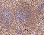 CD180 Antibody in Immunohistochemistry (Paraffin) (IHC (P))