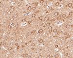 EPHA2 Antibody in Immunohistochemistry (Paraffin) (IHC (P))