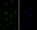 Androgen Receptor Antibody in Immunocytochemistry (ICC/IF)