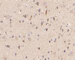 P2RX5 Antibody in Immunohistochemistry (Paraffin) (IHC (P))