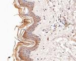 CBR1 Antibody in Immunohistochemistry (Paraffin) (IHC (P))