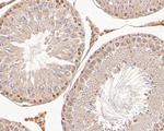 CBR1 Antibody in Immunohistochemistry (Paraffin) (IHC (P))