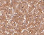 Transferrin Antibody in Immunohistochemistry (Paraffin) (IHC (P))