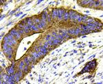 MMP1 Antibody in Immunohistochemistry (Paraffin) (IHC (P))