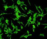 HSP27 Antibody in Immunocytochemistry (ICC/IF)