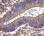 HSP27 Antibody in Immunohistochemistry (Paraffin) (IHC (P))