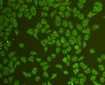 CD31 Antibody in Immunocytochemistry (ICC/IF)
