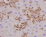 AFP Antibody in Immunohistochemistry (Paraffin) (IHC (P))