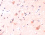 ERAB Antibody in Immunohistochemistry (IHC)
