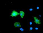 ERBB2 Antibody in Immunocytochemistry (ICC/IF)