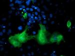 ERBB2 Antibody in Immunocytochemistry (ICC/IF)