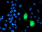 ERBB2 Antibody in Immunocytochemistry (ICC/IF)