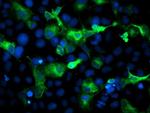 ERBB2 Antibody in Immunocytochemistry (ICC/IF)