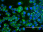 ERBB2 Antibody in Immunocytochemistry (ICC/IF)
