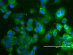 ERBB2 Antibody in Immunocytochemistry (ICC/IF)