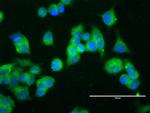 ERBB2 Antibody in Immunocytochemistry (ICC/IF)