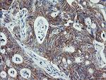 ERBB2 Antibody in Immunohistochemistry (Paraffin) (IHC (P))